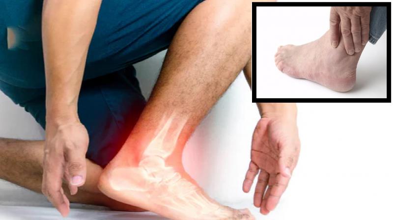 What are the reasons for increase in uric acid? News in hindi