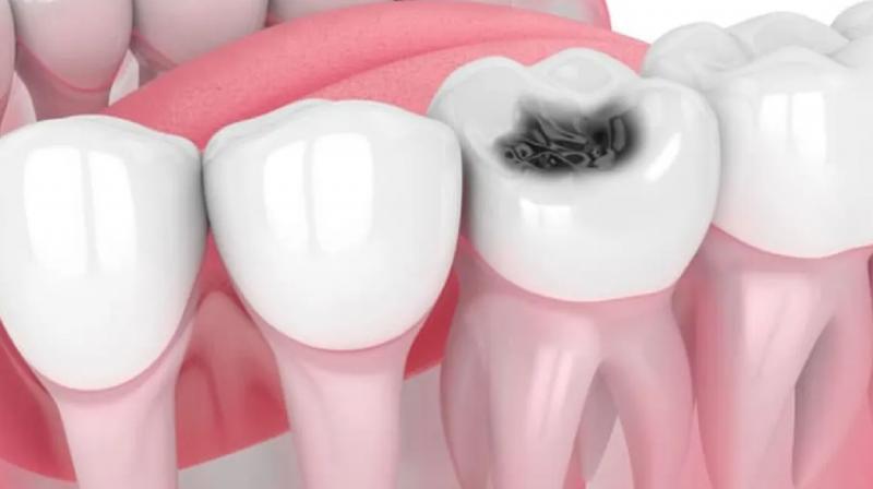 Say goodbye to cavities with this kitchen ingredient News In Hindi Say goodbye to cavities with this kitchen ingredient News In Hindi