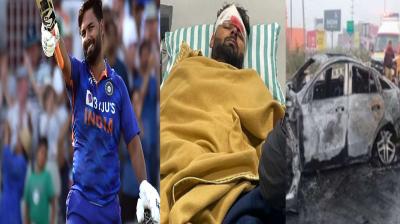 Rishabh Pant Car Accident: Indian cricket team's wicketkeeper Rishabh Pant injured in road accident, injuries ..
