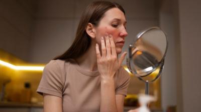 Natural Remedies tips for Sun Damaged Skin News In Hindi